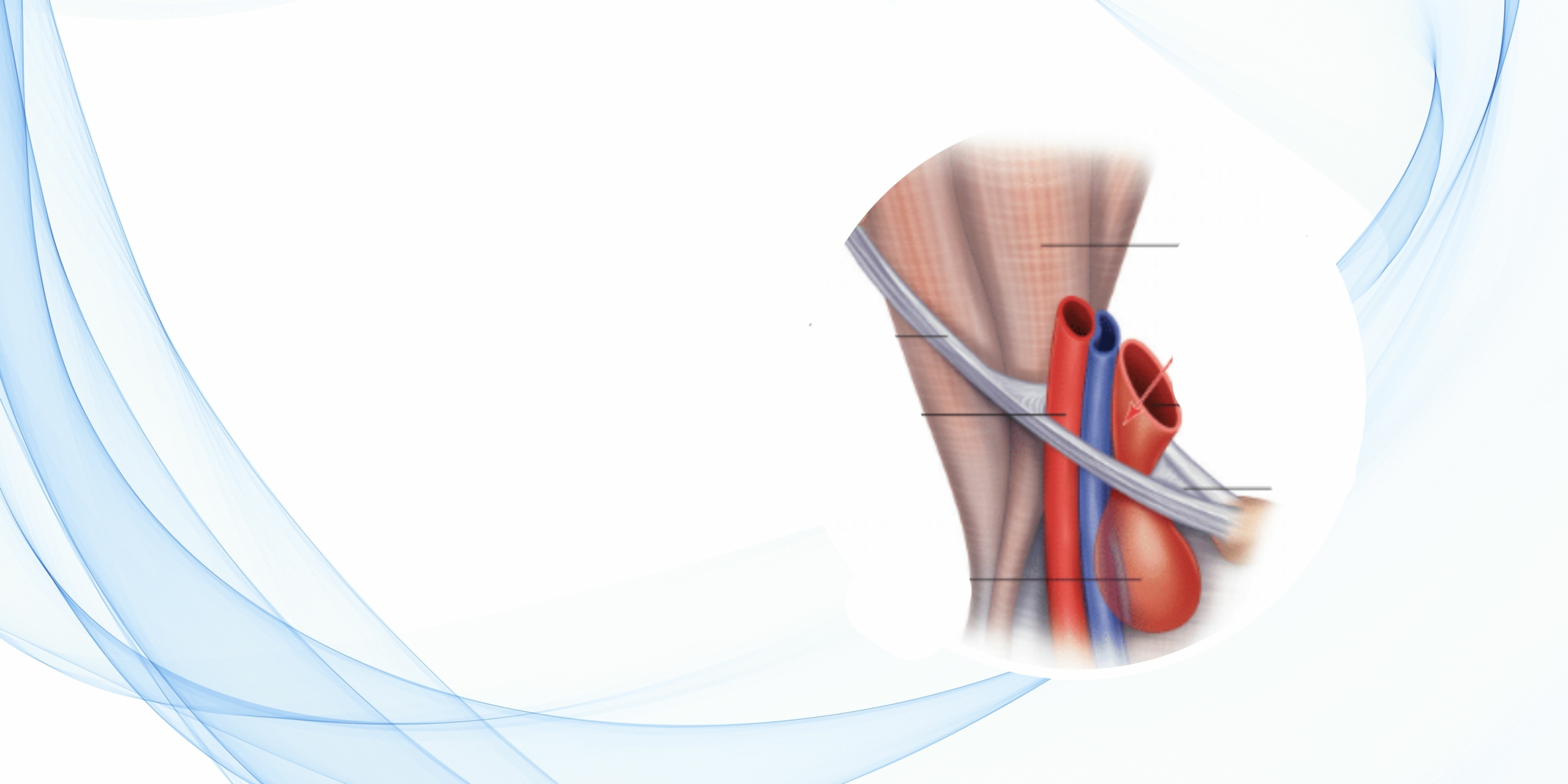 blog-region-y-hernia-femoral