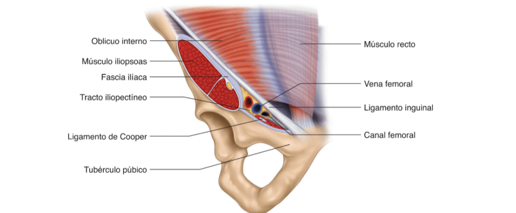 hernia-femoral
